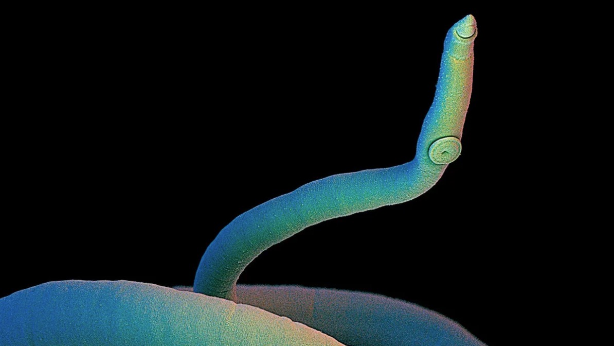 Close-up of a female blood fluke, a parasitic worm that causes schistosomiasis in humans. Credit: David Scharf/Science Source