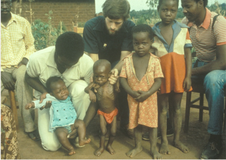 A family in Zaire shows malnourished children
