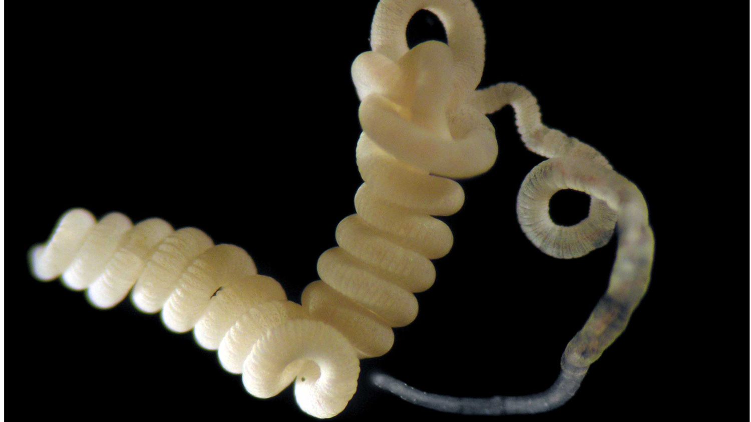 The gutless marine worm Olavius algarvensis was used as a test case for the new technique. This worm does not have a digestive system and instead is fed by a community of symbiotic bacteria living in the worm. Photo courtesy of Christian Lott. 