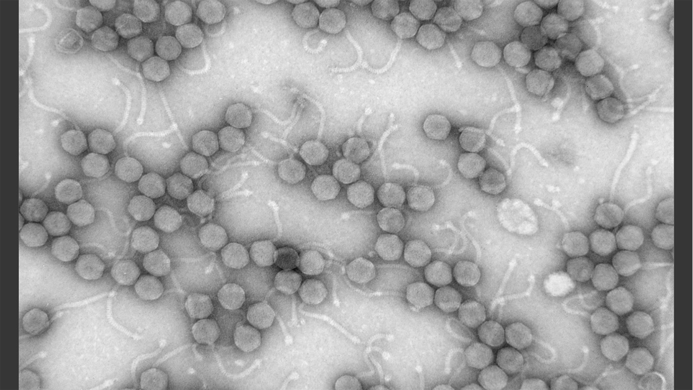Photo of tiny bacteriophages taken from lab.