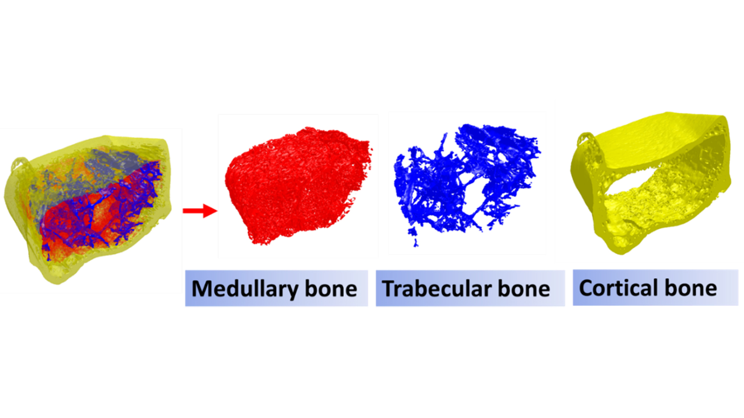 3-D rendering showing medullary, trabecular and cortical bone separated out