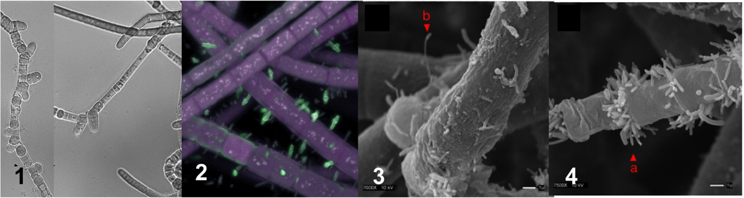 Microscope images of HT-58-2