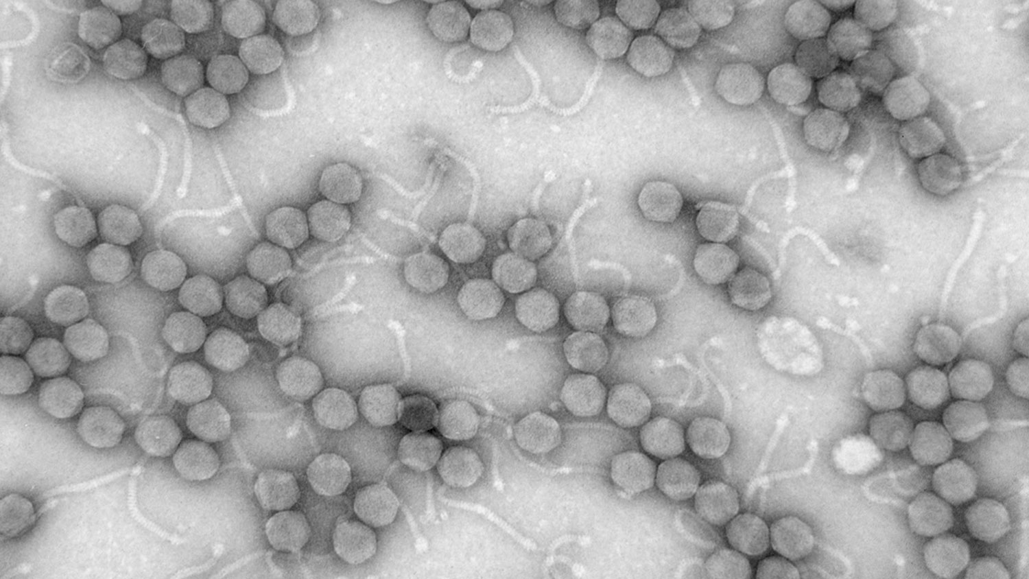 Image of Mycobacterium smegmatis phage MicroWolf; H. Hendricks, NC State Phage Hunters.