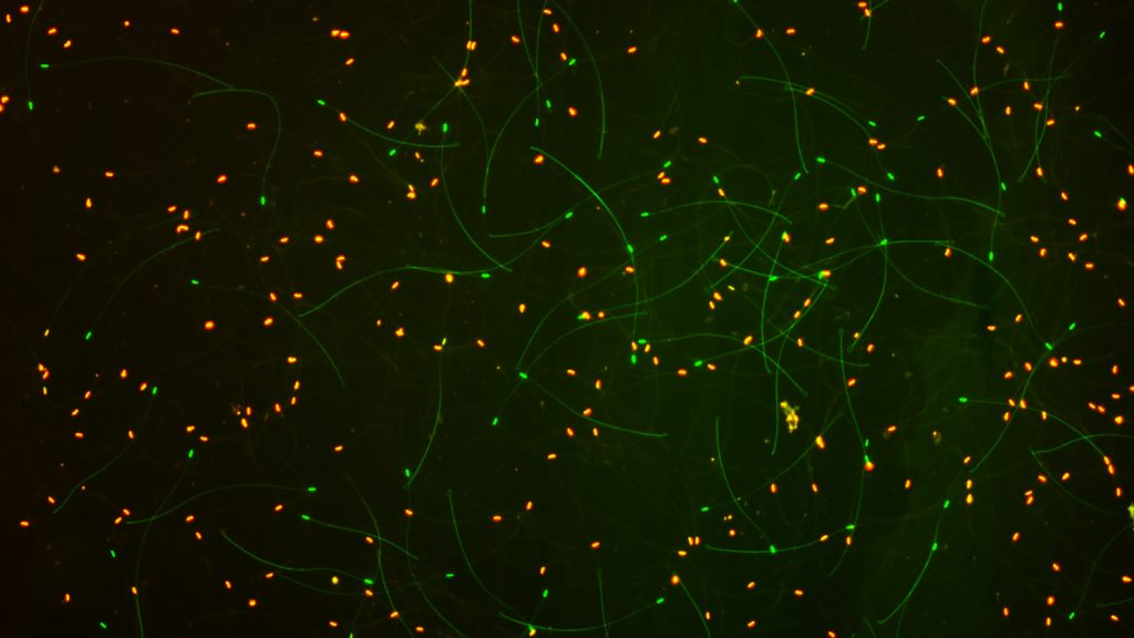 Scientists measured sperm viability with a technique called fluorescent staining. Green dots signify live sperm, while red ones are dead. This image is of mostly dead sperm from a failed queen.