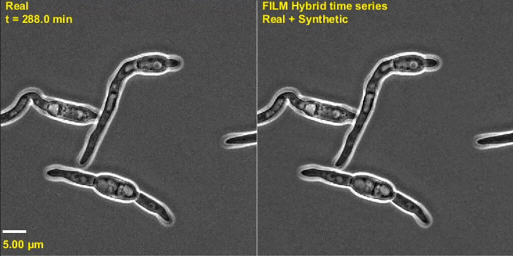 black and white microscopy images of the fungal plant pathogen (C. acutatum)