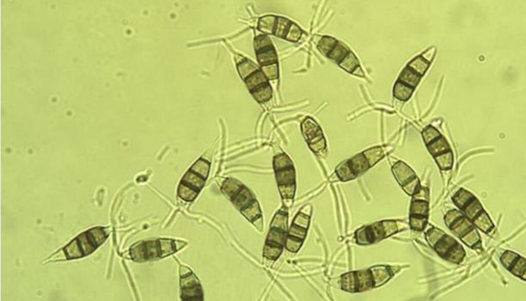 A much magnified view of fungi, each with give differently colored segments and hairlike structures at one end.