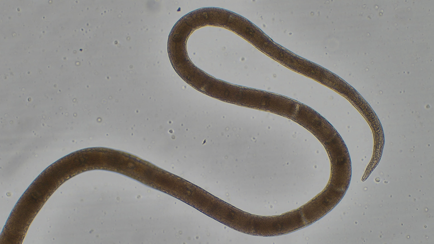 a microscopic image of a brown/gray parasite