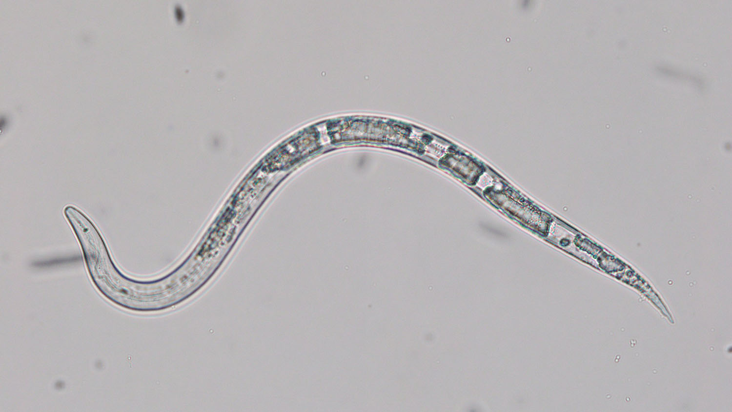A Northern root-knot nematode under the microscope.