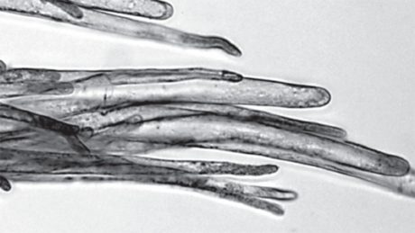 A black and white microscopic image of a bunch of finger-like cotton fibers.